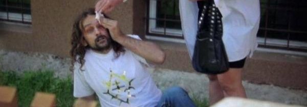 Nádejný kandidát na ocenenie HOVNO ROKA 2017.- Viete, čo majú spoločné Lorenz a …