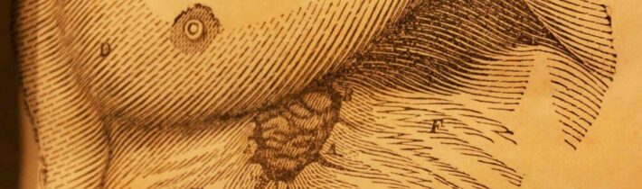 Píštěl žaludku – Kabinet Kuriozit