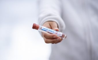 Pri sobotnom PCR testovaní pribudlo 2282 nakazených SARS-CoV-2