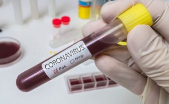 Vyšetrovanie pôvodu koronavírusu je v kritickom bode, dostalo sa do slepej uličky