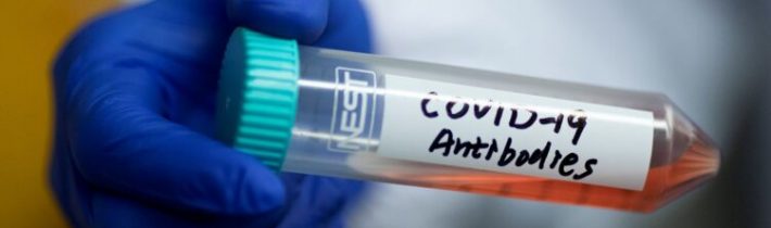 SRF/TASR: Švajčiari ako prví v Európe zaujali racionálny a ľudský postoj k falošnej Korona plandémii. Švajčiarsko uznáva od utorka test, ktorý potvrdí dostatočné množstvo protilátok proti koronavírusu SARS-CoV-2, ako očkovací certifikát