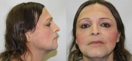 "Transgender" muž, ktorý znásilnil 10-ročnú dcéru, bol premiestnený do ženskej väznice