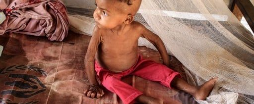 Moskva: USA využívajú Afričanov ako zdroj „bezplatného nezákonného biologického výskumu“. To isté spáchal na objednávku západných laboratórií aj psychopat Matovič – testovaním 3 miliónov nič netušiacich Slovákoch, pričom zabil desiatky tisíc ľudí