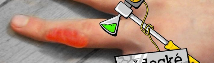 Jak se tvoří puchýře a mozoly? – Vědecké kladivo