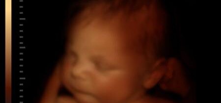 Správcovia katolíckej školskej rady v Toronte verejne vyjadrili nesúhlas s návrhmi v prospech života