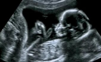 Známe potratové zariadenie v Illinois odmietlo žiadosť o výnimku zo zdravotných noriem