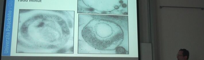 Michal Křupka – Existuje opravdu chronická lymská borelióza? (Pátečníci 30.8.2019)