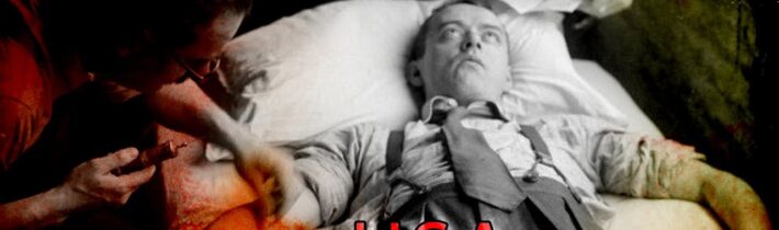 AMERIČANÉ ZÁMĚRNĚ NAKAZILI OBYVATELE GUATEMALY SYFILIDOU! Ohavné experimenty Díl 3.