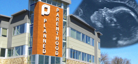 POČÚVAJTE: Zamestnanci plánovaného rodičovstva sa smejú pri volaní na tiesňovú linku pre ženu krvácajúcu po potrate