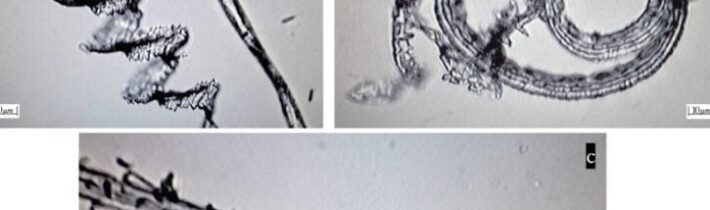 Neuvěříte, jaké BIZARNÍ NANOSTRUKTURY NAŠLI JAPONŠTÍ VĚDCI V MRNA COVID PSEUDO-VAKCÍNÁCH od Pfizeru a Moderny (VIDEO)