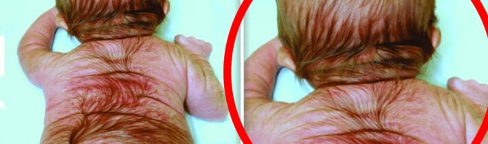 Matka ho opustila a milionáři si ho adoptovali. To, co udělal po letech, všechny šokovalo…