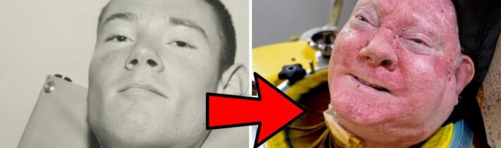 Muž, Který Je Zamčený 76 Let V Tomhle Stroji