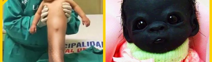 20 Dětí, Které Se Rodí Jen Jednou Za Tisíc Let