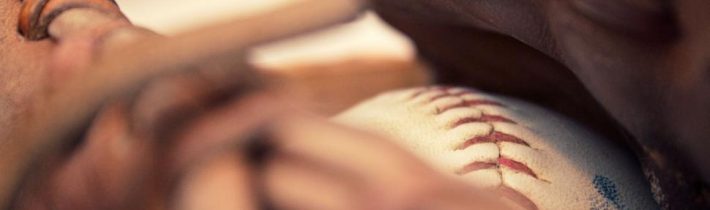 Elegantní maskování prdíků