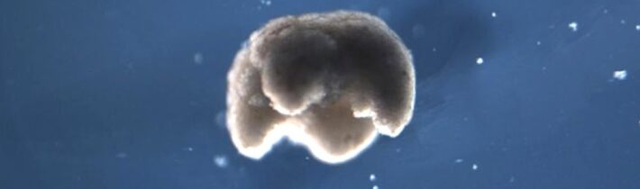 Xenobot: Na pomezí života a stroje – Proč to řešíme? #776