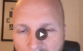 Naživo? jaro veď tu vyzeráš ako po lobotomii