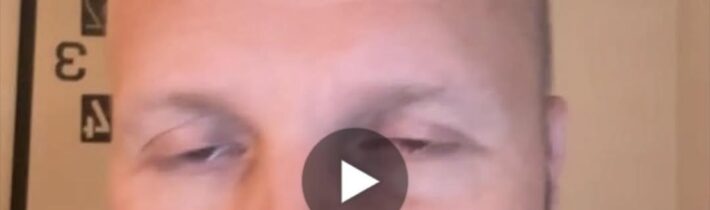 Naživo? jaro veď tu vyzeráš ako po lobotomii