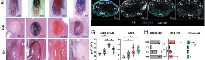 Škodlivý vplyv tetovania na imunitný systém